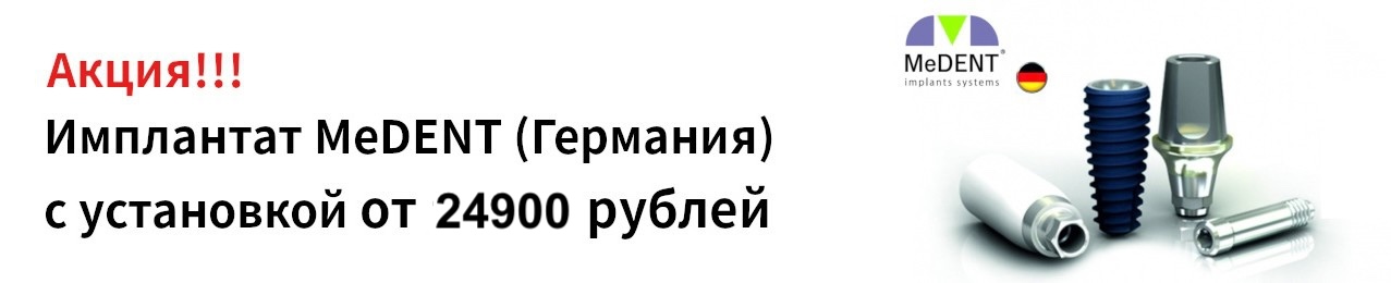 Имплантант MeDENT (Германия) с установкой от 24900 рублей